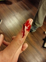 Image: Schnittwunde am Finger mit Wachs geschmikt